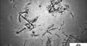 Ship-related debris on the sea floor, including an anchor